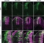 PAX3 Antibody in Immunohistochemistry (IHC)