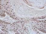 PAX3 Antibody in Immunohistochemistry (IHC)