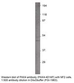 PAX4 Polyclonal Antibody