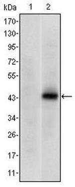 PAX4 Monoclonal Antibody (3C12)