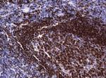 PAX5 Antibody in Immunohistochemistry (Paraffin) (IHC (P))