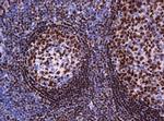 PAX5 Antibody in Immunohistochemistry (Paraffin) (IHC (P))