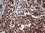PAX5 Antibody in Immunohistochemistry (Paraffin) (IHC (P))