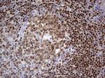 PAX5 Antibody in Immunohistochemistry (Paraffin) (IHC (P))