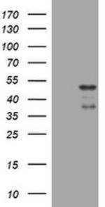 PAX5 Antibody in Western Blot (WB)