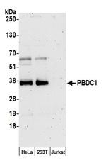 PBDC1 Polyclonal Antibody