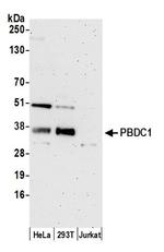PBDC1 Polyclonal Antibody