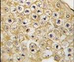 PBK Antibody in Immunohistochemistry (IHC)