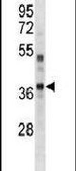 PBK Antibody in Western Blot (WB)