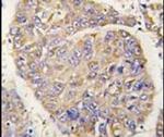 PEBP1 Antibody in Immunohistochemistry (IHC)