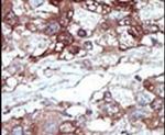 PEBP1 Antibody in Immunohistochemistry (IHC)