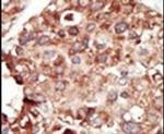 PEBP1 Antibody in Immunohistochemistry (IHC)