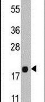 PEBP1 Antibody in Western Blot (WB)