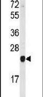PEBP1 Antibody in Western Blot (WB)