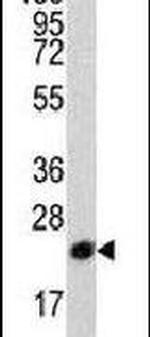 PEBP1 Antibody in Western Blot (WB)