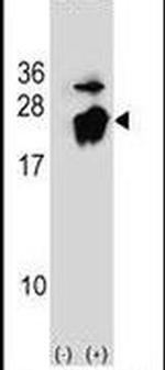 PEBP1 Antibody in Western Blot (WB)