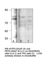 Phospho-BTK (Tyr551) Polyclonal Antibody