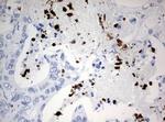 PBX1 Antibody in Immunohistochemistry (Paraffin) (IHC (P))
