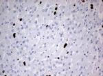 PBX1 Antibody in Immunohistochemistry (Paraffin) (IHC (P))