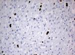 PBX1 Antibody in Immunohistochemistry (Paraffin) (IHC (P))