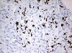 PBX1 Antibody in Immunohistochemistry (Paraffin) (IHC (P))
