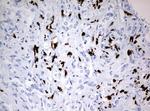 PBX1 Antibody in Immunohistochemistry (Paraffin) (IHC (P))