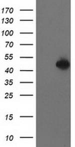 PBX1 Antibody in Western Blot (WB)