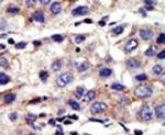 CBX4 Antibody in Immunohistochemistry (IHC)