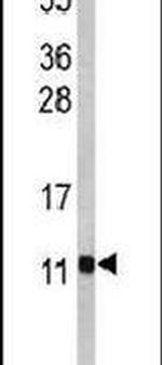 PCBD1 Antibody in Western Blot (WB)