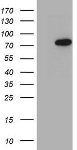 PCCA Antibody in Western Blot (WB)