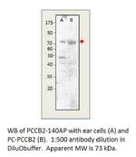 Phospho-CACNB2 (Ser621) Polyclonal Antibody