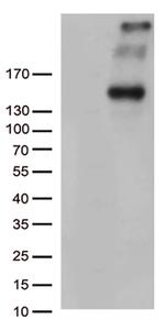 PCDH15 Antibody in Western Blot (WB)