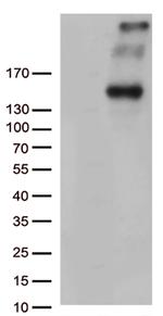 PCDH15 Antibody in Western Blot (WB)