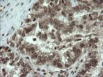 PCDH7 Antibody in Immunohistochemistry (Paraffin) (IHC (P))
