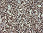 PCDH7 Antibody in Immunohistochemistry (Paraffin) (IHC (P))