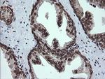 PCDH7 Antibody in Immunohistochemistry (Paraffin) (IHC (P))