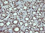PCDH7 Antibody in Immunohistochemistry (Paraffin) (IHC (P))