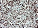 PCDH7 Antibody in Immunohistochemistry (Paraffin) (IHC (P))