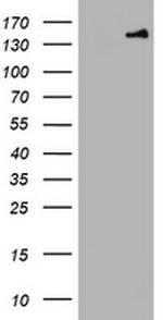 PCDH7 Antibody in Western Blot (WB)