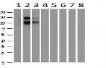 PCDH7 Antibody in Western Blot (WB)