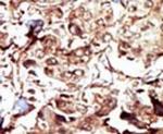 PCK2 Antibody in Immunohistochemistry (IHC)