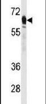 PCK2 Antibody in Western Blot (WB)