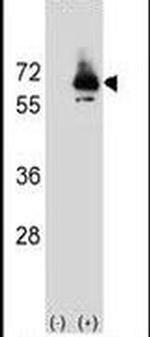 PCK2 Antibody in Western Blot (WB)