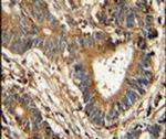 PID1 Antibody in Immunohistochemistry (IHC)