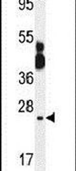 PID1 Antibody in Western Blot (WB)