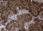 PCNA Antibody in Immunohistochemistry (Paraffin) (IHC (P))