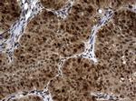 PCNA Antibody in Immunohistochemistry (Paraffin) (IHC (P))