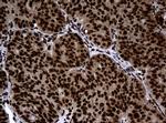 PCNA Antibody in Immunohistochemistry (Paraffin) (IHC (P))