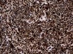 PCNA Antibody in Immunohistochemistry (Paraffin) (IHC (P))
