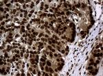 PCNA Antibody in Immunohistochemistry (Paraffin) (IHC (P))